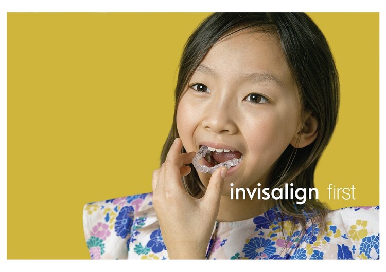 マウスピース矯正（インビザライン）イメージ