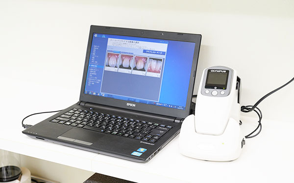 ホワイトニング専用ライトと歯科専用測色カメラの導入