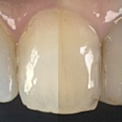 ⑥クリスタルアイにて色の確認